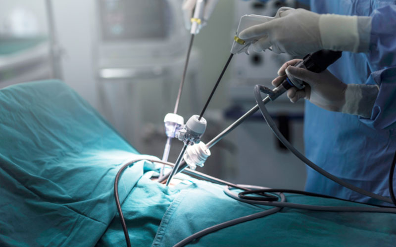 Laparoscopy surgery Laparoscopic Surgeon in Sharjah, Dubai