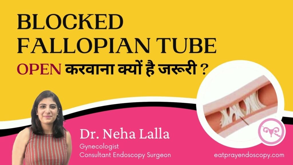 Blocked Fallopian Tubes and Pregnancy