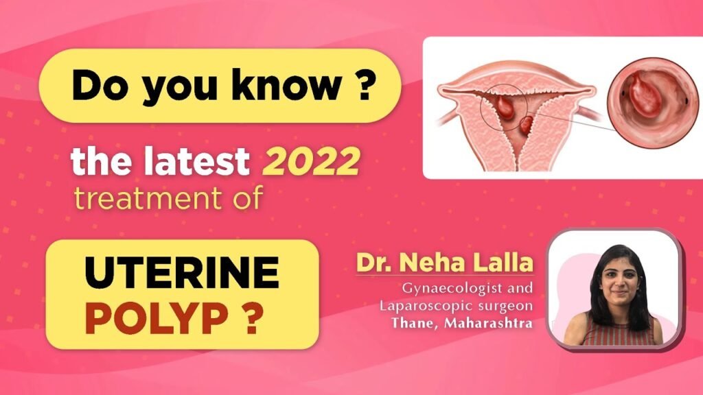 Uterine Polyp Treatment 2022 | Hysteroscopy kya hota hai | Heavy Menstrual Bleeding