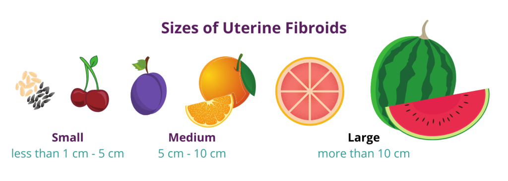 Sizes of Uterine Fibroids