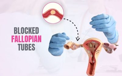 Blocked Fallopian Tubes