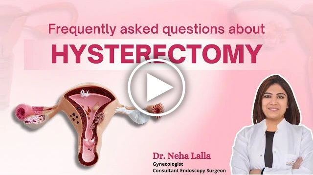 Frequently Asked Questions on Hysterectomy