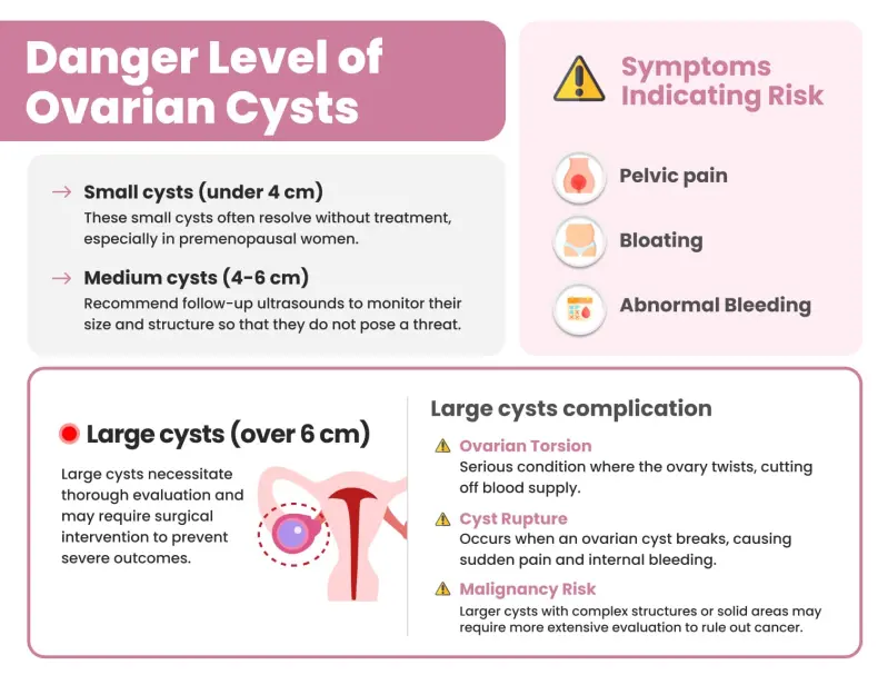 Danger Level of Ovarian Cysts