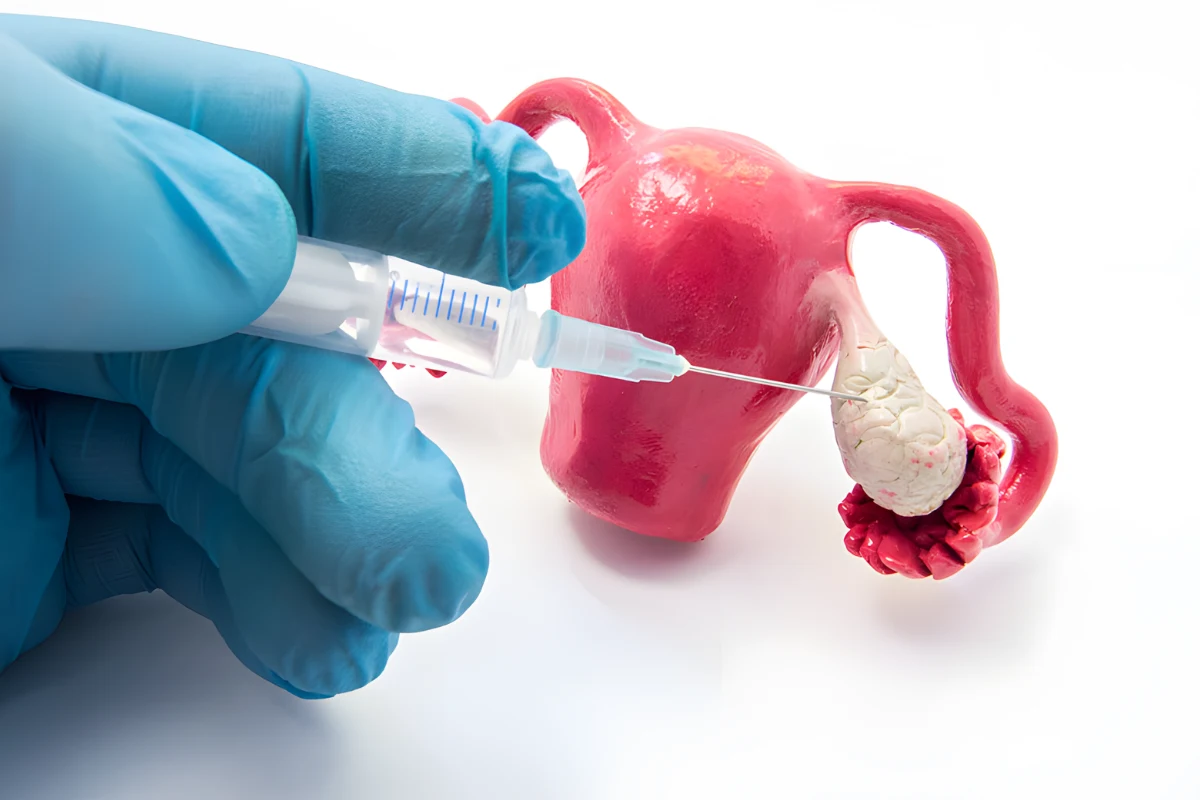 Trying to Conceive? Ovulation Induction Explained