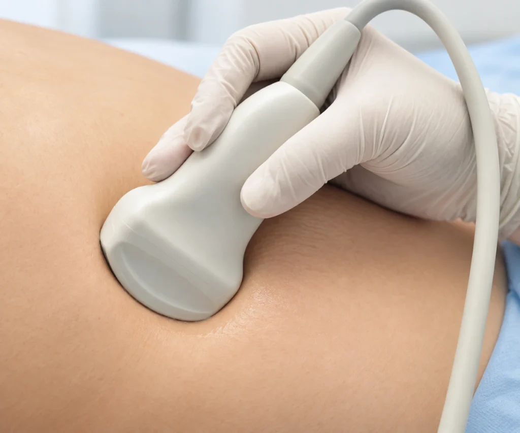 Ultrasound examination related to tubal ligation assessment